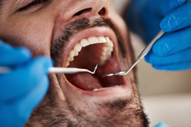 Best Emergency Root Canal Treatment in Edmonton, KY